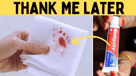 how to remove fake blood from white clothes|what dissolves dried blood.